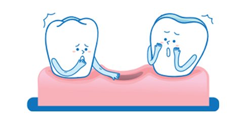 빠진 이 자리 양옆에서 놀라는 치아 캐릭터 2개(분홍 잇몸)
